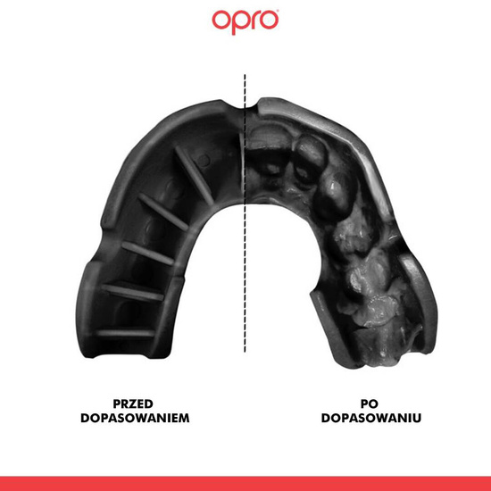 Ochraniacz na zęby Opro Bronze Czarny
